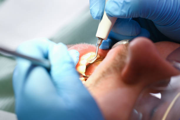 Best Tooth Pain Emergency Relief  in Woodlake, VA