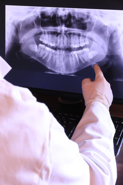 Best Emergency Dental Filling Replacement  in Woodlake, VA